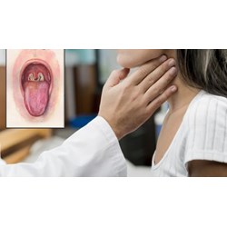 Có thể bị nhiễm bệnh bạch hầu khi tiếp xúc với đồ vật hay không?