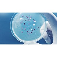 Vi khuẩn bạch hầu sống sót được ở các vật dụng bên ngoài môi trường?