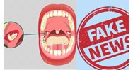 Mức phạt khi đăng tin sai sự thật về dịch bệnh bạch hầu lên mạng xã hội