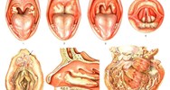 Quy định về tiêu chí đánh giá nguy cơ dịch bệnh bạch hầu ra sao?