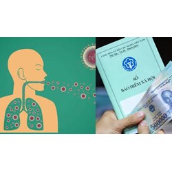 Mắc bệnh lao phổi có được hưởng BHXH một lần không?