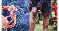 GDCD 8 bài 14: Phòng, chống nhiễm HIV/AIDS