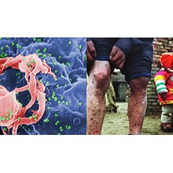 GDCD 8 bài 14: Phòng, chống nhiễm HIV/AIDS
