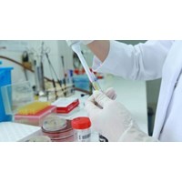 Giám định bổ sung khi nào trong tố tụng hình sự?