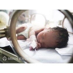 Làm giấy khai sinh cho trẻ được sinh ra ở nước ngoài ?