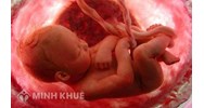 Chế độ thai sản áp dụng khi thai chết lưu theo quy định mới nhất