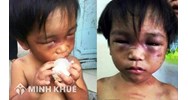 Hành vi bạo hành trẻ em sẽ xử lý như thế nào theo luật hình sự?