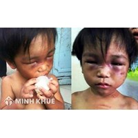 Hành vi bạo hành trẻ em sẽ xử lý như thế nào theo luật hình sự?