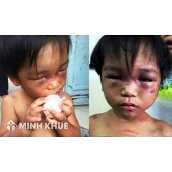 Hành vi bạo hành trẻ em sẽ xử lý như thế nào theo luật hình sự?