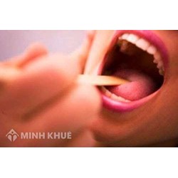 Mổ amidan ở quê mà ua bảo hiểm y tế tại thành phố có được giảm viện phí ?