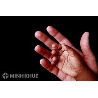 Legal consultancy on adoption (Domestically or Involving foreign elements)