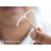 Lao động nữ đặt vòng tránh thai có được hưởng chế độ thai sản không?