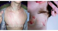 Xem xét dấu vết trên thân thể là gì? Thẩm quyền và nguyên tắc xem xét dấu vết trên thân thể và so sánh với biện pháp khám xét người