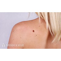Điều tra viên xem xét dấu vết trên thân thể như thế nào?