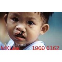 Tư vấn về đăng ký hưởng trợ cấp khuyết tật cho trẻ em khuyết tật ?