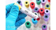 Quy định pháp luật về giám sát dịch tễ học HIV/AIDS và giám sát các nhiễm trùng lây qua đường tình dục