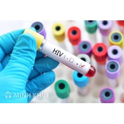 Quy định pháp luật về giám sát dịch tễ học HIV/AIDS và giám sát các nhiễm trùng lây qua đường tình dục