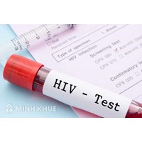 Điều kiện và thủ tục đề nghị cấp Giấy chứng nhận cơ sở đủ điều kiện xét nghiệm khẳng định các trường hợp HIV dương tính