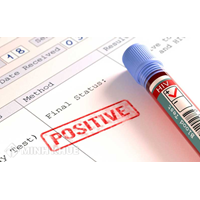 Quy định pháp luật về trình tự thông báo kết quả xét nghiệm HIV dương tính