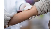 Trình tư, nội dung tư vấn xét nghiệm HIV tại cộng đồng được thực hiện như thế nào?