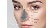 Phòng khám chuyên khoa thẩm mỹ là gì? Quy định về việc thành lập phòng khám chuyên khoa thẩm mỹ
