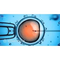 Mức phạt hành chính hành vi vi phạm quy định về sinh con bằng kỹ thuật thụ tinh trong ống nghiệm