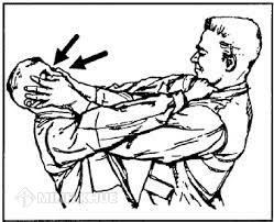 Thế nào là vượt quá yêu cầu tình thế cấp thiết? Có bị phạt tù không?