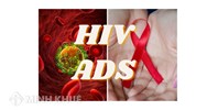 HIV là gì? Người nhiễm HIV có được hưởng trợ cấp xã hội không?