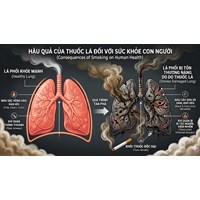 Thuyết minh về tác hại của thuốc lá chọn lọc hay nhất