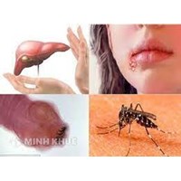 Bệnh truyền nhiễm là gì? Các bệnh truyền nhiễm thường gặp?