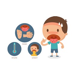Tội làm lây lan dịch bệnh truyền nhiễm nguy hiểm cho người Điều 240 BLHS
