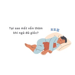 Tại sao mắt vẫn thâm khi ngủ đủ giấc?