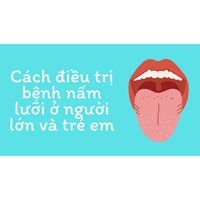 Cách điều trị bệnh nấm lưỡi ở người lớn và trẻ em