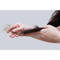 Tóc rụng là thiếu chất gì? Để ngăn ngừa rụng tóc cần bổ sung chất gì?