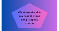 Một số nguyên nhân gây rụng tóc từng mảng (alopecia areata)