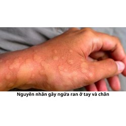 Nguyên nhân gây ngứa ran ở tay và chân