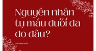 Nguyên nhân tụ máu dưới da do đâu ?