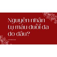 Nguyên nhân tụ máu dưới da do đâu ?