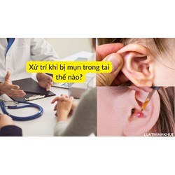 Xử trí khi bị mụn trong tai thế nào?