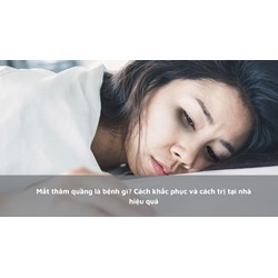 Mắt thâm quầng là bệnh gì? Cách khắc phục và cách trị tại nhà hiệu quả