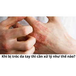 Khi bị tróc da tay thì cần xử lý như thế nào?
