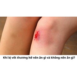 Khi bị vết thương hở nên ăn gì và không nên ăn gì?