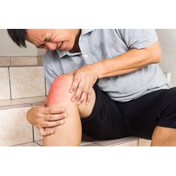 Nên ăn gì và kiêng gì khí bị tràn dịch khớp gối