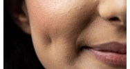 Vì sao lại có má lúm đồng tiền?