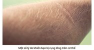 Một số lý do khiến bạn bị rụng lông trên cơ thể