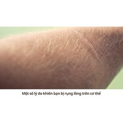 Một số lý do khiến bạn bị rụng lông trên cơ thể