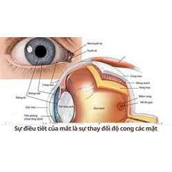 Sự điều tiết của mắt là sự thay đổi độ cong các mặt