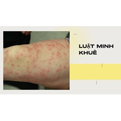 Cơ thể bị ngứa là dấu hiệu của việc thiếu chất gì theo dân gian?