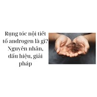 Rụng tóc nội tiết tố androgen là gì? Nguyên nhân, dấu hiệu, giải pháp