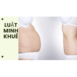 Các cách đơn giản để giảm tích nước trong cơ thể